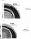 Fig. 06 - Optimized Posterior Surface for Toric Contact Lenses