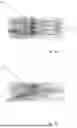 Fig. 06 - SPEAKER UNIT FOR A HEARING AID DEVICE SYSTEM, AND HEARING AID DEVICE SYSTEM