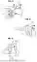 Fig. 09 - MEDICAL SCOPE DEVICE, STEERING SYSTEM, AND RELATED METHODS