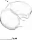Fig. 10 - IMPLANTABLE RF SENSOR FOR BIOFILM DETECTION