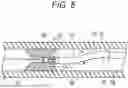 Fig. 06 - MEDICAL DEVICE