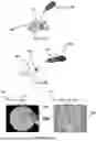 Fig. 20 - SYSTEM AND METHOD FOR COMPUTER-AIDED SURGICAL NAVIGATION IMPLEMENTING 3D SCANS