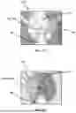 Fig. 28 - SYSTEM AND METHOD FOR COMPUTER-AIDED SURGICAL NAVIGATION IMPLEMENTING 3D SCANS