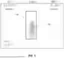 Fig. 30 - FULL-SCANNER BARRIER FOR AN INTRA-ORAL DEVICE