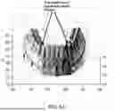Fig. 09 - MAGNETIC POSITIONING SYSTEMS AND METHODS FOR DENTAL PROCEDURES AND APPLICATIONS
