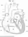 Fig. 04 - PROSTHETIC HEART VALVE THAT REDUCES NATIVE ANNULUS