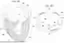 Fig. 05 - PROSTHETIC HEART VALVE THAT REDUCES NATIVE ANNULUS