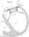Fig. 11 - PROSTHETIC HEART VALVE THAT REDUCES NATIVE ANNULUS