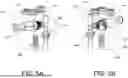 Fig. 08 - PUMP OVERPRESSURE RELIEF FEATURE FOR A PENILE PROSTHESIS