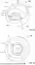 Fig. 02 - Offset Resurfacing Head for Ball and Socket Joint