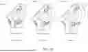 Fig. 06 - Humeral Reconstruction System and Methods of Use