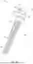 Fig. 07 - Humeral Reconstruction System and Methods of Use