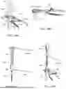 Fig. 46 - Humeral Reconstruction System and Methods of Use