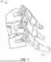 Fig. 02 - INTEGRAL GRAFT INTERBODY DEVICES