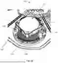 Fig. 07 - DEVICE FOR PROVIDING HEATING AND COOLING THERAPY TO A SHOULDER