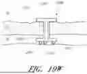 Fig. 43 - DRUG ELUTING OCULAR IMPLANTS