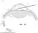 Fig. 53 - DRUG ELUTING OCULAR IMPLANTS