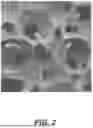 Fig. 03 - Negative Pressure Therapy Systems and Sponges