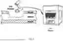 Fig. 04 - Negative Pressure Therapy Systems and Sponges