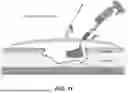 Fig. 12 - Negative Pressure Therapy Systems and Sponges
