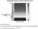 Fig. 22 - METHODS AND COMPOSITIONS FOR TREATING DIABETES, AND METHODS FOR ENRICHING MRNA CODING FOR SECRETED PROTEINS