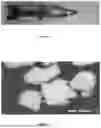 Fig. 02 - METHODS FOR TREATING LEAKAGE FROM A GASTROINTESTINAL SITE