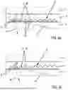 Fig. 03 - ARRANGEMENT WITH ILLUMINABLE PANE