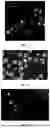 Fig. 09 - POLYMER MICROPARTICLE, PREPARATION METHOD THEREFOR AND USE THEREOF