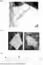 Fig. 02 - METHOD OF PRODUCING FUNGAL MATS AND MATERIALS MADE THEREFROM