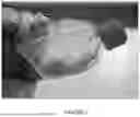 Fig. 02 - COMPOSITIONS AND METHODS FOR USING SMALL MOBILE STEM CELLS