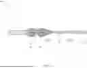 Fig. 09 - MULTILATERAL LATERAL BORE COMPLETION EMPLOYING DEGRADABLE MATERIAL