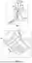 Fig. 09 - ORTHOPEDIC ARTHROSCOPIC OPTICAL CANNULA SYSTEM