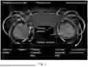 Fig. 02 - Synthetic Particle Confinement Synthesis And Uses Thereof