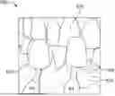Fig. 01 - SYSTEMS AND METHODS FOR TOOTH SHADE IMAGING IN DENTAL TREATMENT