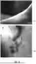 Fig. 09 - OFFSET ILLUMINATION CAPILLAROSCOPE