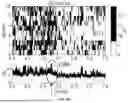Fig. 09 - METHOD FOR DETECTING COMPLEX TARGET IN PEDESTRIAN RE-IDENTIFICATION VIDEO STREAMS BASED ON EVENT-RELATED POTENTIAL (ERP)