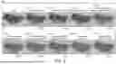 Fig. 05 - Deep Learning Models For Tumor Evaluation