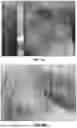 Fig. 04 - Systems and Methods for Negative Pressure Grain Imbibition