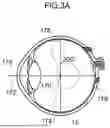 Fig. 04 - SYSTEMS AND METHODS FOR COMBINING FUNDUS IMAGES OF AN EYE