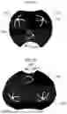 Fig. 09 - SYSTEMS AND METHODS FOR COMBINING FUNDUS IMAGES OF AN EYE