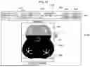 Fig. 17 - SYSTEMS AND METHODS FOR COMBINING FUNDUS IMAGES OF AN EYE