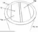 Fig. 55 - SECURABLE DEVICE HAVING A SUBSTANTIALLY FLEXIBLE SHAFT AND ONE OR MORE PROTRUSIONS AND METHOD FOR SECURING THE SAME