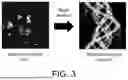 Fig. 04 - METHOD FOR PLACE RE-RECOGNITION OF MOBILE ROBOT BASED ON LIDAR ESTIMABLE POSE