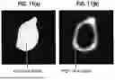 Fig. 16 - LEFT ATRIUM SHAPE RECONSTRUCTION FROM SPARSE LOCATION MEASUREMENTS USING NEURAL NETWORKS