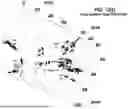 Fig. 17 - LEFT ATRIUM SHAPE RECONSTRUCTION FROM SPARSE LOCATION MEASUREMENTS USING NEURAL NETWORKS