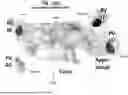 Fig. 19 - LEFT ATRIUM SHAPE RECONSTRUCTION FROM SPARSE LOCATION MEASUREMENTS USING NEURAL NETWORKS