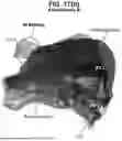 Fig. 29 - LEFT ATRIUM SHAPE RECONSTRUCTION FROM SPARSE LOCATION MEASUREMENTS USING NEURAL NETWORKS