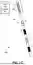 Fig. 04 - LEAD CONFIGURED TO DETECT STROKE METRICS