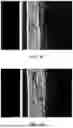 Fig. 09 - METHODS, DEVICES, AND SYSTEMS FOR IMPROVING SKIN CHARACTERISTICS
