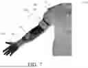Fig. 08 - UNDER-ACTUATED SOFT EXOSKELETON WITH CABLE ACTUATION SYSTEM FOR UPPER LIMB ASSISTANCE